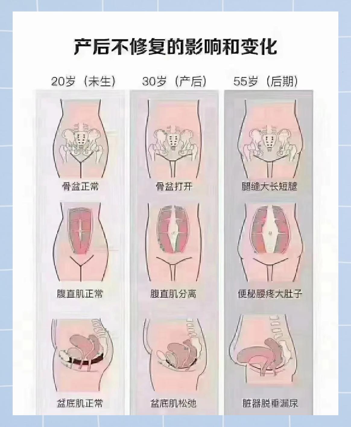 产后显老和显年轻的秘密 女人生娃后如何保持年轻