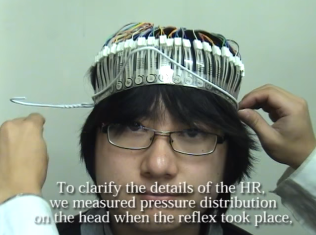 衣架套在头上,会有一股神秘力量让头转动,这到底是怎...