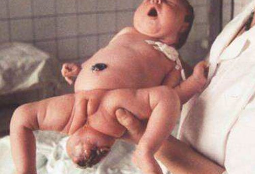 切尔诺贝利“变异生物”向外迁移，会对地球生态造成怎...