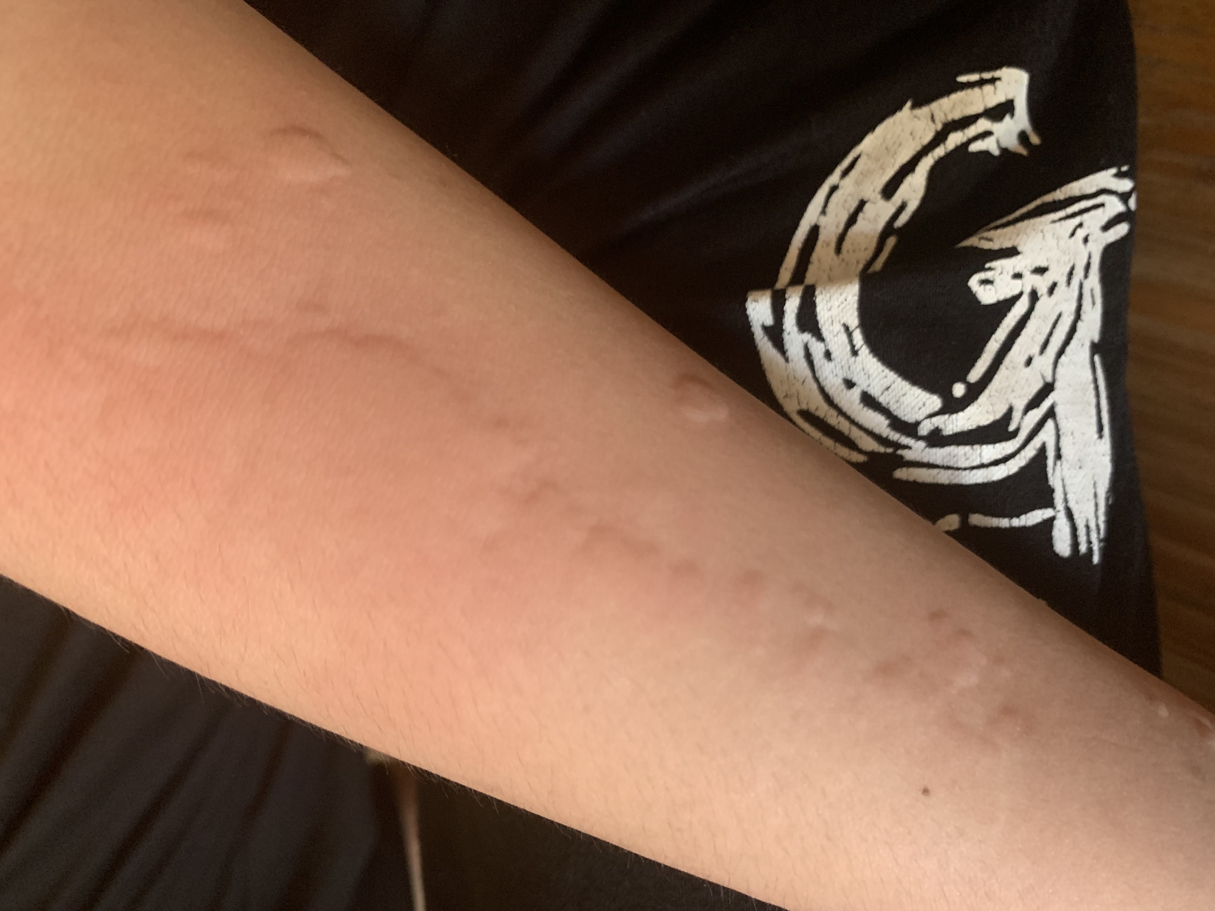 为什么中国和外国的食物过敏诱因会存在明显地域性差异...