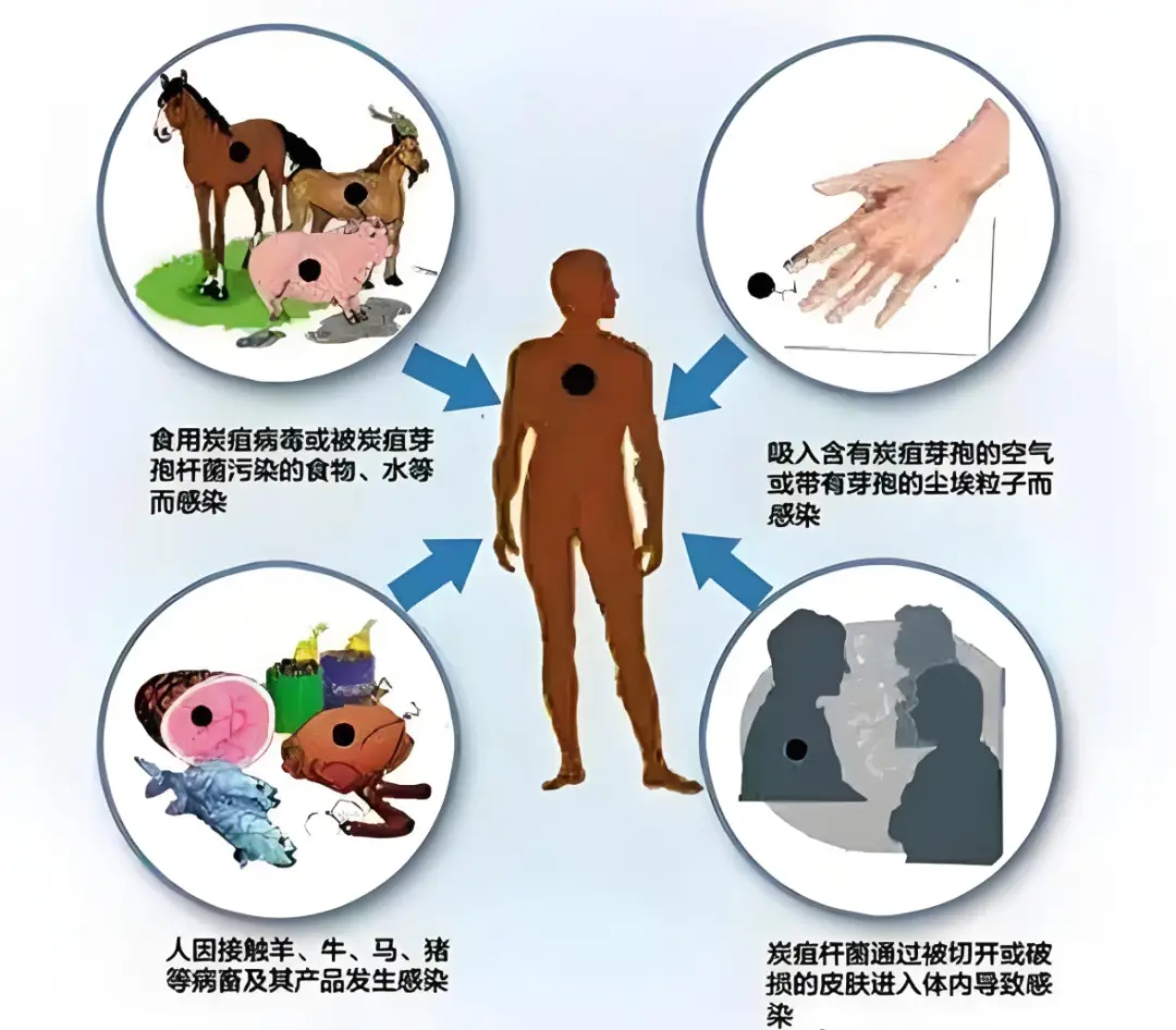 炭疽病传染途径有哪些 动物感染炭疽会怎样