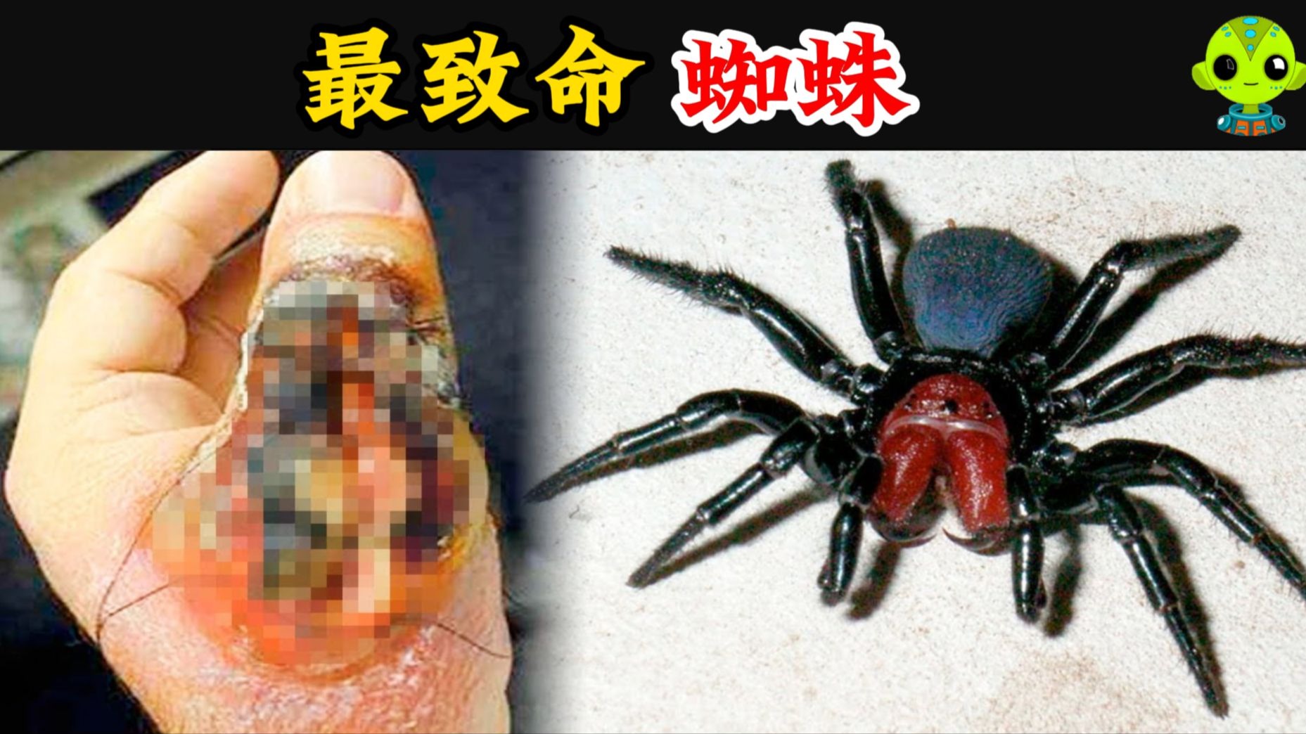 世界最毒蜘蛛，男性被咬后，会引发持续数小时的「生理...