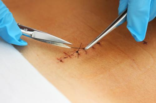 用夸克大小的细丝快速切割人体，会发生什么惊人后果？